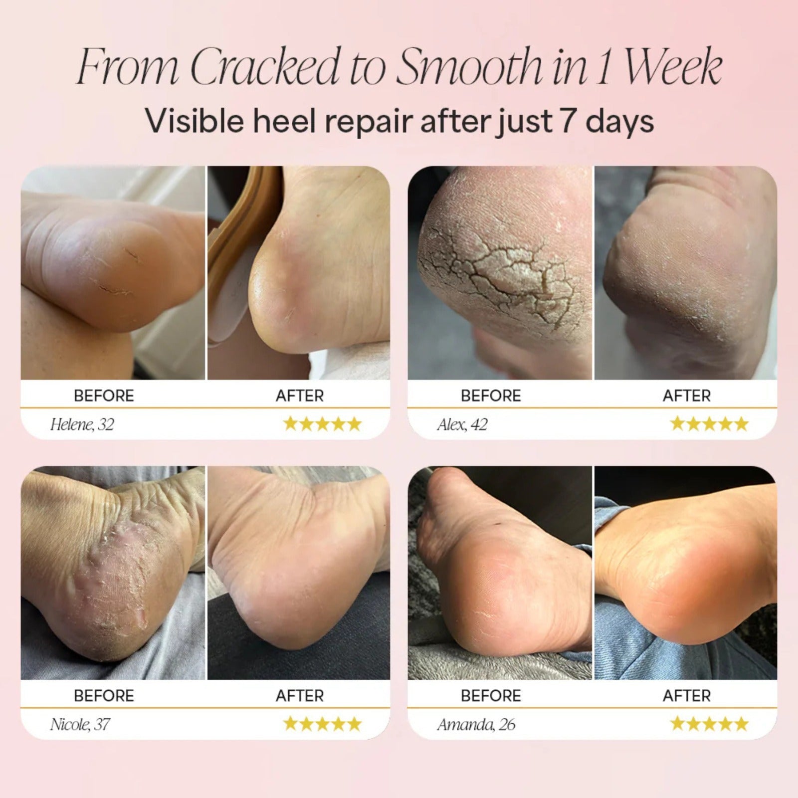 Velvasol Anti Crack Stick