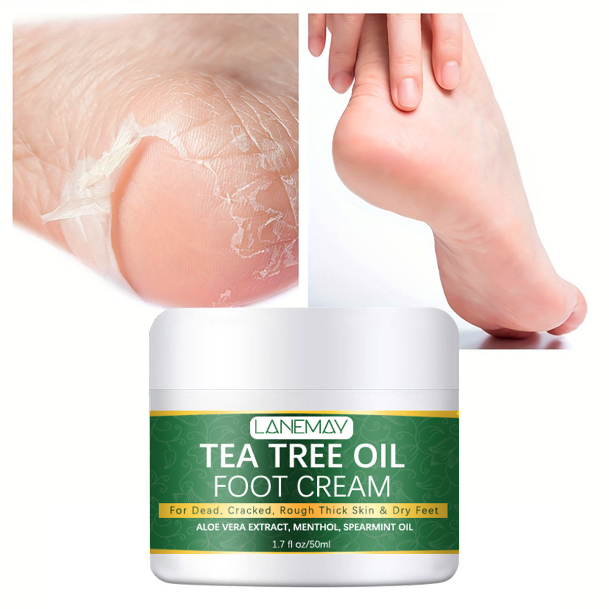 Velvasol Soft Heels Cream – with Tea Tree Oil